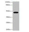 Lysosomal acid lipase/cholesteryl ester hydrolase antibody, A54716-100, Epigentek, Western Blot image 