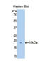 Profilin 2 antibody, LS-C299836, Lifespan Biosciences, Western Blot image 