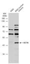 POU Class 3 Homeobox 1 antibody, GTX134041, GeneTex, Western Blot image 