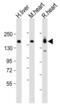 Myosin Binding Protein C, Cardiac antibody, MBS9215190, MyBioSource, Western Blot image 