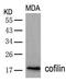 Cofilin 1 antibody, 79-344, ProSci, Western Blot image 