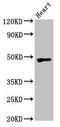 WD Repeat And SOCS Box Containing 1 antibody, orb400388, Biorbyt, Western Blot image 