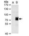 AT-Rich Interaction Domain 5A antibody, NBP2-15459, Novus Biologicals, Western Blot image 