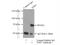 Tyrosyl-DNA Phosphodiesterase 1 antibody, 10641-1-AP, Proteintech Group, Immunoprecipitation image 