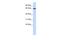 EBF Family Member 4 antibody, A16618, Boster Biological Technology, Western Blot image 