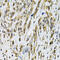 Ras Homolog Family Member A antibody, 15-286, ProSci, Immunohistochemistry paraffin image 