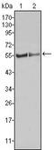 FGR Proto-Oncogene, Src Family Tyrosine Kinase antibody, GTX83208, GeneTex, Western Blot image 