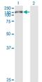 Cell Migration Inducing Hyaluronidase 1 antibody, H00057214-M01, Novus Biologicals, Western Blot image 