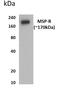 Macrophage Stimulating 1 Receptor antibody, GTX52933, GeneTex, Western Blot image 