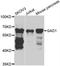 Glutamate Decarboxylase 1 antibody, A2938, ABclonal Technology, Western Blot image 