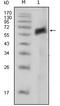 AXL Receptor Tyrosine Kinase antibody, MA5-15504, Invitrogen Antibodies, Western Blot image 