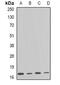 ADP Ribosylation Factor 1 antibody, abx141697, Abbexa, Western Blot image 