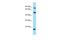 ADP Ribosylation Factor Like GTPase 4C antibody, A09250, Boster Biological Technology, Western Blot image 