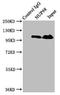 Nucleoporin 98 antibody, LS-C674962, Lifespan Biosciences, Immunoprecipitation image 