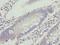 Vacuolar Protein Sorting 25 Homolog antibody, LS-C398088, Lifespan Biosciences, Immunohistochemistry frozen image 