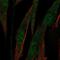 ATP Binding Cassette Subfamily A Member 8 antibody, NBP1-91641, Novus Biologicals, Immunofluorescence image 