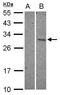 DNA Damage Inducible Transcript 3 antibody, PA5-34848, Invitrogen Antibodies, Western Blot image 