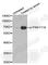 Paxillin antibody, AP0156, ABclonal Technology, Western Blot image 