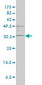 Tryptase Alpha/Beta 1 antibody, LS-C105045, Lifespan Biosciences, Western Blot image 