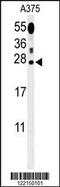 Inosine Triphosphatase antibody, TA324796, Origene, Western Blot image 