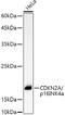 Cyclin-dependent kinase inhibitor 2A, isoforms 1/2/3 antibody, GTX03119, GeneTex, Western Blot image 