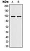 Transient Receptor Potential Cation Channel Subfamily V Member 4 antibody, LS-B14080, Lifespan Biosciences, Western Blot image 