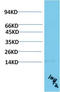 Transthyretin antibody, STJ98891, St John