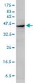 Actin Alpha 2, Smooth Muscle antibody, H00000059-M02, Novus Biologicals, Western Blot image 