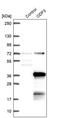 Outer Dense Fiber Of Sperm Tails 3 antibody, PA5-58591, Invitrogen Antibodies, Western Blot image 