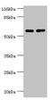 Protein Phosphatase 2 Regulatory Subunit B'Gamma antibody, LS-C676304, Lifespan Biosciences, Western Blot image 