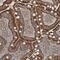 Sodium Channel And Clathrin Linker 1 antibody, PA5-57717, Invitrogen Antibodies, Immunohistochemistry paraffin image 