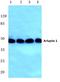 ADP Ribosylation Factor Interacting Protein 1 antibody, A09689-1, Boster Biological Technology, Western Blot image 
