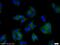 HLA class I histocompatibility antigen, B-8 alpha chain antibody, 17260-1-AP, Proteintech Group, Immunofluorescence image 