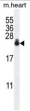 Adaptor Related Protein Complex 1 Subunit Sigma 3 antibody, AP50200PU-N, Origene, Western Blot image 