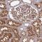 Tensin 3 antibody, PA5-63238, Invitrogen Antibodies, Immunohistochemistry paraffin image 
