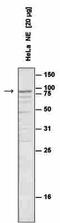 SUZ12 Polycomb Repressive Complex 2 Subunit antibody, CI1003, Boster Biological Technology, Western Blot image 