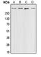 CREB Binding Protein antibody, orb213780, Biorbyt, Western Blot image 