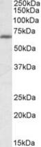 IKAROS Family Zinc Finger 1 antibody, MBS421728, MyBioSource, Western Blot image 