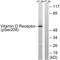 Vitamin D Receptor antibody, LS-C199727, Lifespan Biosciences, Western Blot image 