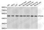 Protein Disulfide Isomerase Family A Member 6 antibody, A3366, ABclonal Technology, Western Blot image 