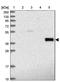 Adh-3 antibody, NBP1-90232, Novus Biologicals, Western Blot image 