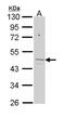 Ferrochelatase, mitochondrial antibody, PA5-29733, Invitrogen Antibodies, Western Blot image 