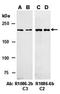 Tet Methylcytosine Dioxygenase 2 antibody, orb67239, Biorbyt, Western Blot image 