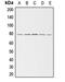 Adducin 3 antibody, GTX54942, GeneTex, Western Blot image 