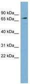 Solute Carrier Family 7 Member 2 antibody, TA334148, Origene, Western Blot image 