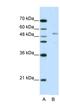 G-Rich RNA Sequence Binding Factor 1 antibody, NBP1-57315, Novus Biologicals, Western Blot image 