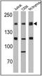 CD45 antibody, MA5-11532, Invitrogen Antibodies, Western Blot image 