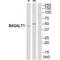 Beta-1,4-Galactosyltransferase 1 antibody, A03993, Boster Biological Technology, Western Blot image 