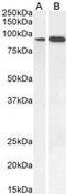 Intraflagellar Transport 88 antibody, GTX89425, GeneTex, Western Blot image 