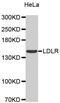 Low Density Lipoprotein Receptor antibody, abx002883, Abbexa, Western Blot image 